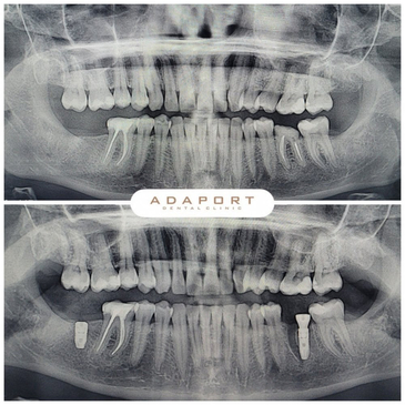 Slider image (2) Adaport Dental Clinic